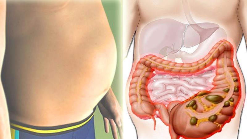 Verursacht Kartoffeln Gas und warum schwillt der Magen an?