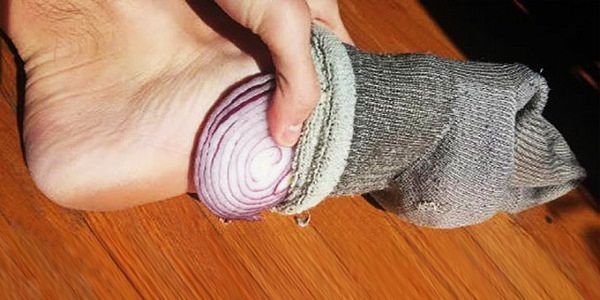 Verwendung von Zwiebeln in Socken für medizinische Zwecke